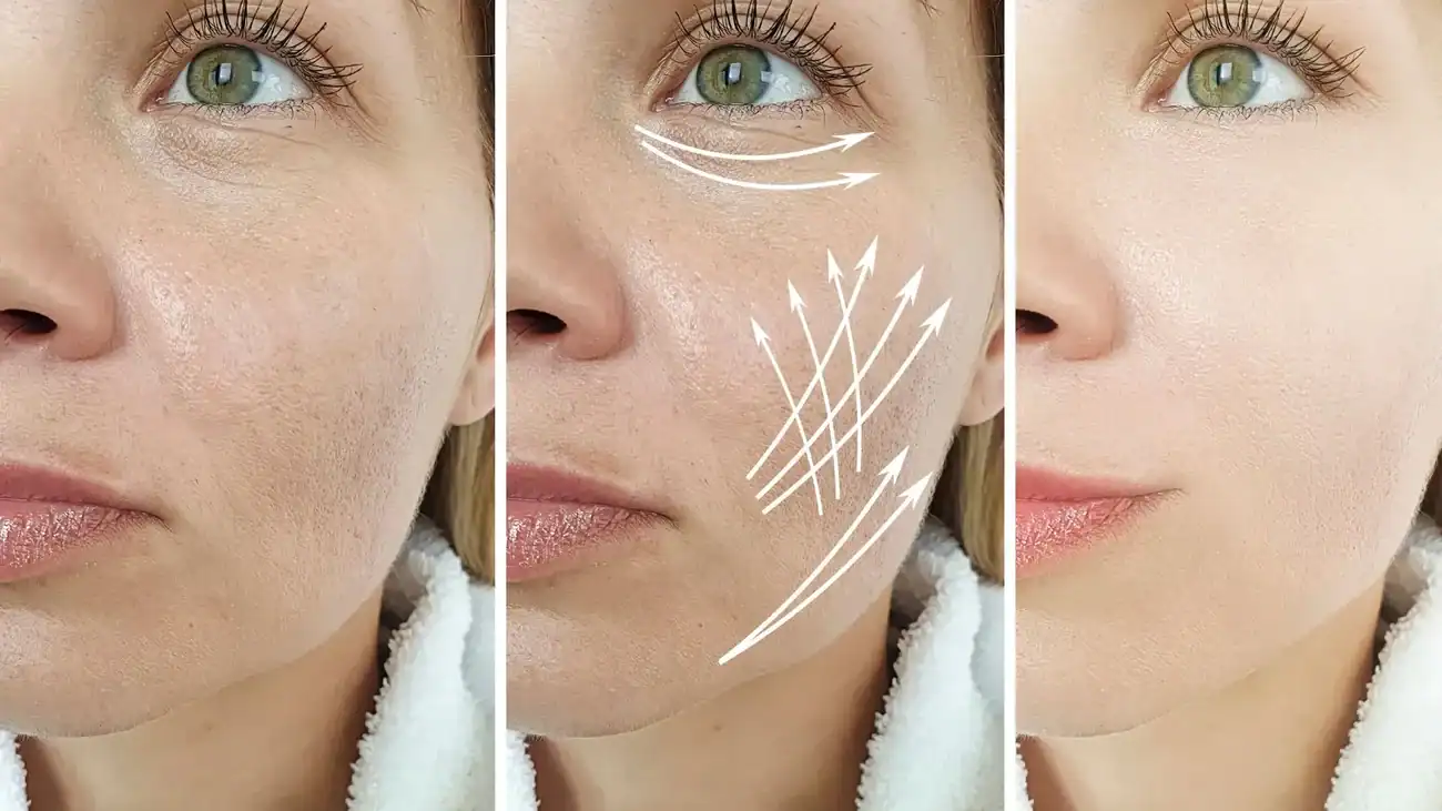 Can One Treatment Really Tackle More Than One Skin Concern East Tilbury?