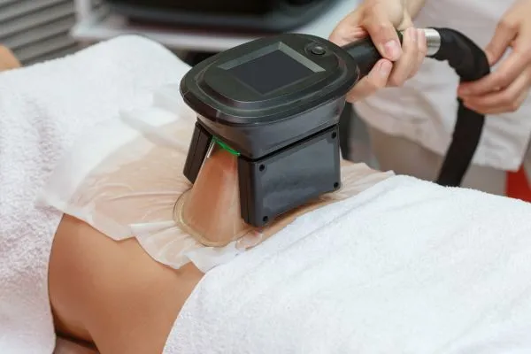 Image of person having fat freezing treatment to help weight gain East Tilbury