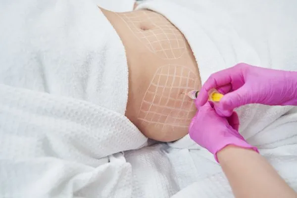 image of fat dissolving injections on love handles to help combat weight gain East Tilbury