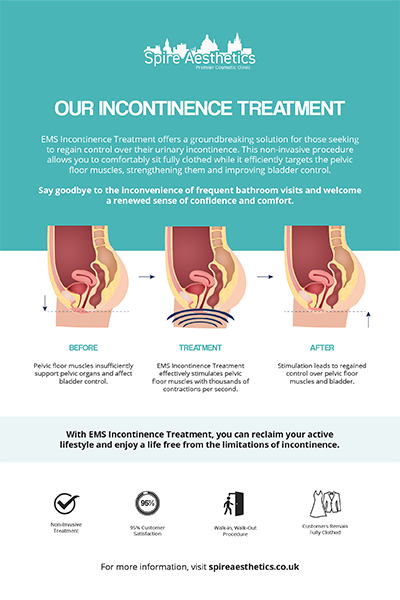 image to show how EMS treatment works for female urinary incontinence East Tilbury