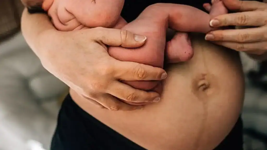 Why Is My Stomach Still Big After Pregnancy East Tilbury?